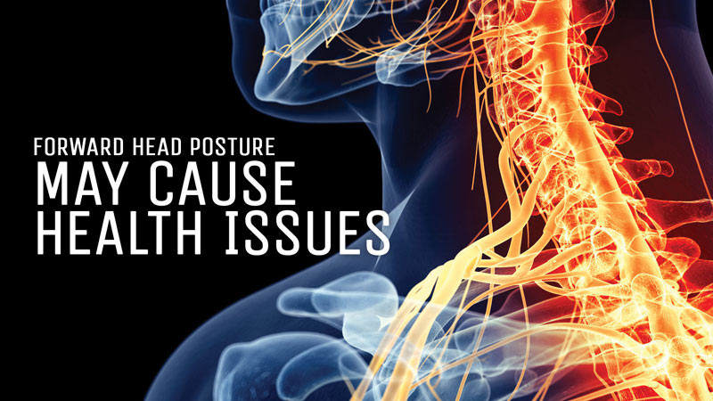 forward-head-posture-may-cause-health-issues